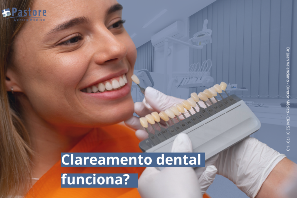 Clareamento Dental: como funciona, quem pode fazer e quais são os resultados