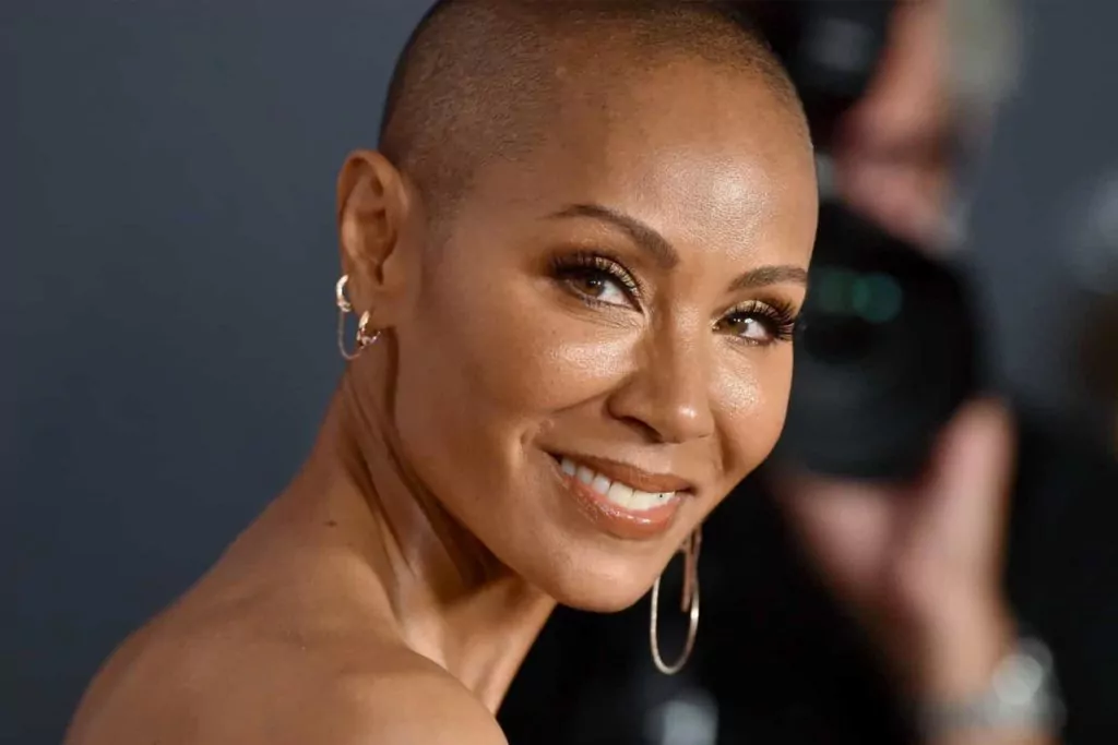 Alopecia: Tudo sobre a doença da Jada Pinkett Smith, esposa de Will Smith