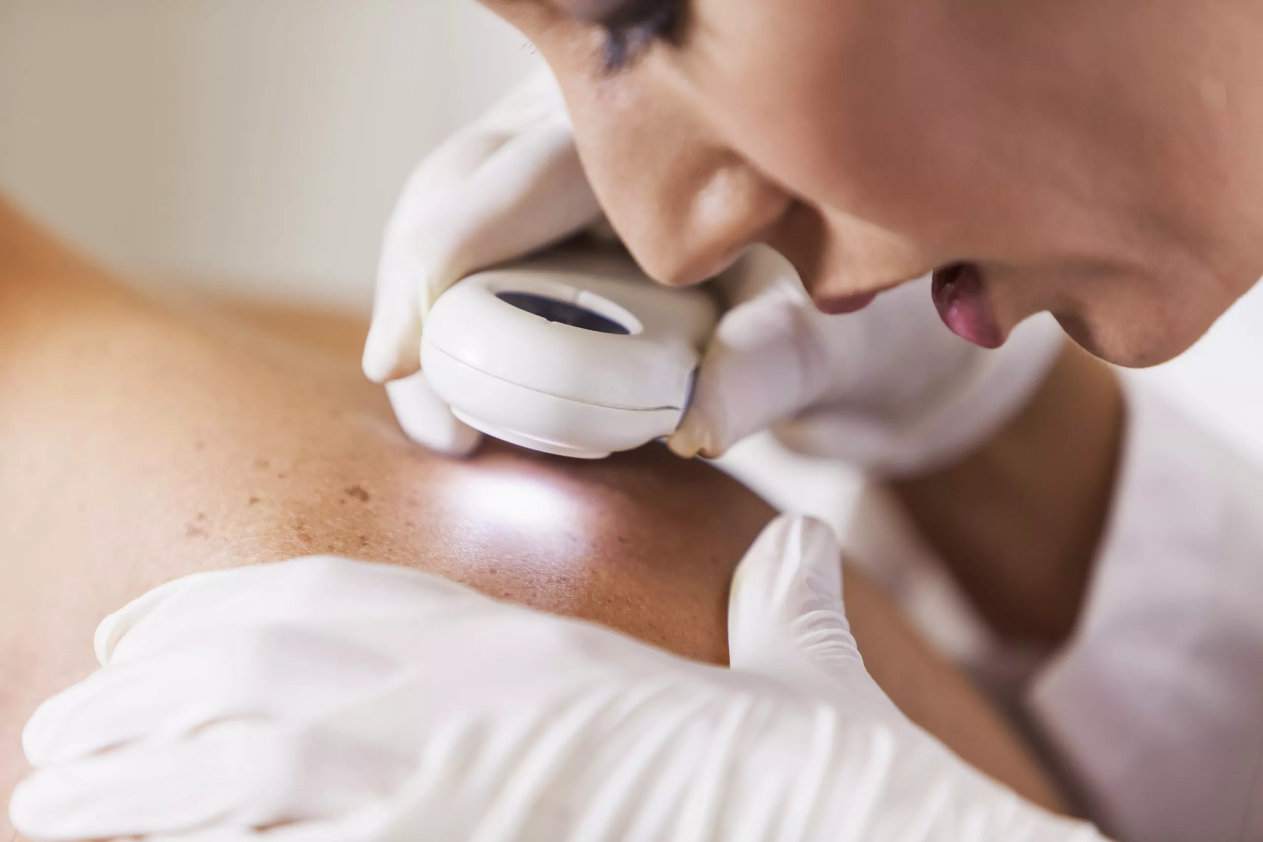 Quando procurar o dermatologista?